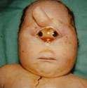 Cyclop1.gif
