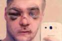 Beaten.jpg
