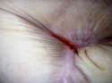 bellybuttonrip[1].jpg