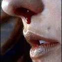 nose-bleed-150x150.jpg