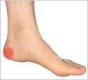 Heel-spur-Image.jpg