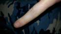 Finger.jpg