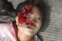 asian-woman-falls-from-height-cracks-her-skull-bares-it-all-05-840x558.jpg