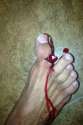 brokentoe.jpg