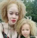 albino2[1].png