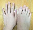 toe3.jpg