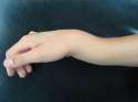 my wrist.jpg