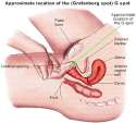 GSpot.jpg