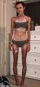 anorexia.jpg