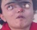 TFWuStubUrToe.png