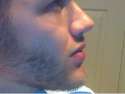 chin.png
