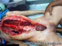 Dude-Fucks-Corpse-780cafbc-0.jpg