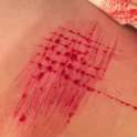 self harm (4).gif