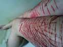 self harm (21).png