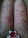 self harm (607).jpg