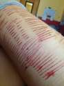 self harm (610).jpg