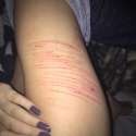 self harm (75).jpg