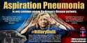 hillary aspiration pneumonia.jpg