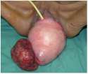 PMC3535739_CRIM.OBGYN2012-727146.001.png