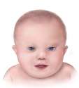 Down_syndrome_lg.jpg