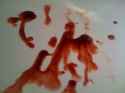 extreme_blood-in-semen.jpg