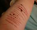 self harm (17).png