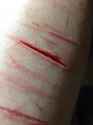 self harm (19).jpg