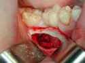 article-new-ehow-images-a06-1e-43-can-become-dental-surgical-assistant_-800x800.jpg