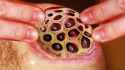 fingers-trypophobia-lotus-pod-cyst-.jpg