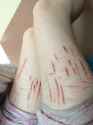 self harm (375).jpg