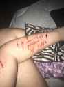 self harm (360).jpg