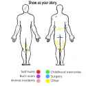 yellowisforstretchmarks.jpg