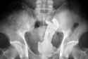 xray19n-1-web.jpg