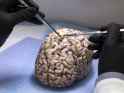 brain_collector_trump_24575419.jpg