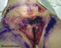 blue-waffle-3.jpg