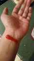 It hurts so bad.jpg