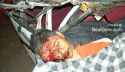 gnarly-skull-cracking-accident-mexico-01-500x291.jpg