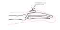 arm xray.png