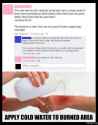 apply cold water to burned area.jpg