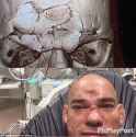 365EB92A00000578-3694715-A_digital_scan_of_Evangelista_Cyborg_s_fractured_skull_above_and-m-6_1468794566432.jpg