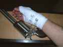 bfr-injury.jpg