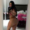 tmp_27064-kardashian-bum-operation-1293493529.jpg