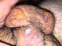 fucking aids of the dick 2.jpg