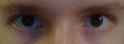 electric eye.png