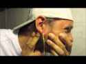 img_864_popping-a-cyst.jpg