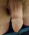 Fiveskin.jpg