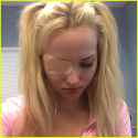 dove-cameron-scratched-eye-pic-tca-nom.jpg