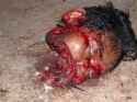 Head of the motorcyclist, lower jaw severed.jpg