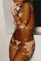 beautiful-vitiligo-341056.jpg