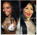 tumblr_static_lil-kim-before-after.jpg.a600999c7762ded735dc666ebc2dac51.jpg